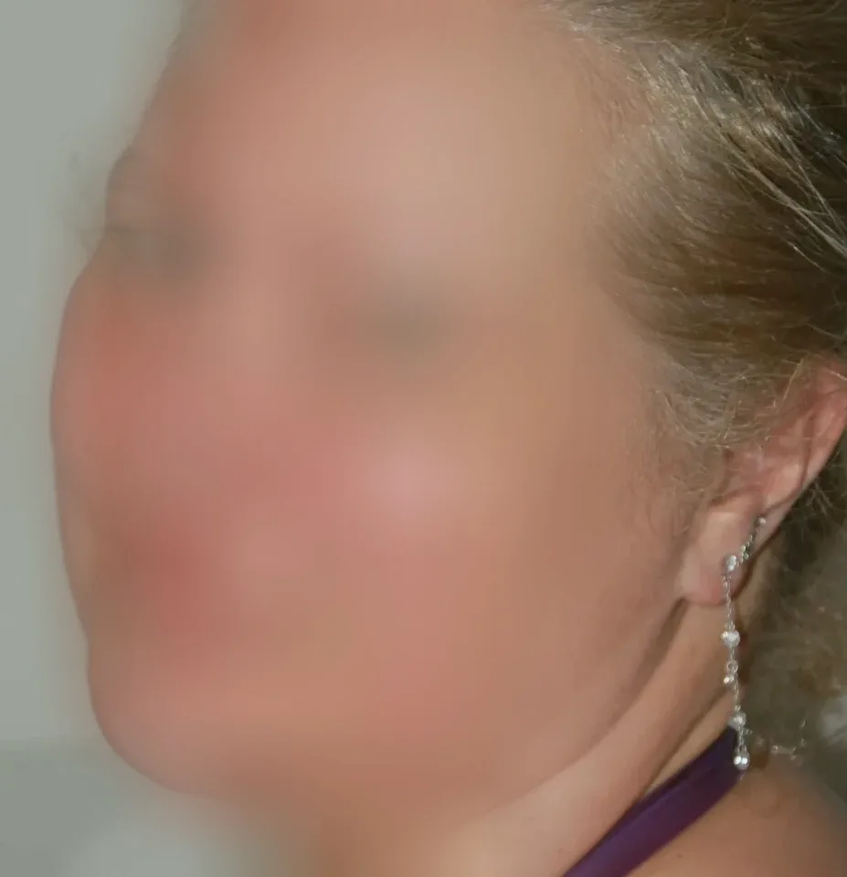 Nora, 28